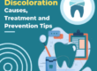 Tooth Discoloration Causes, Treatment and Prevention Tips