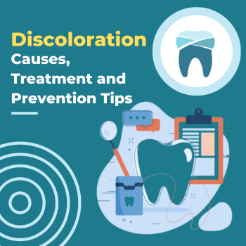 Tooth Discoloration Causes, Treatment and Prevention Tips Tooth Discoloration Causes, Treatment and Prevention Tips