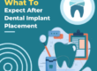 What To Expect After Dental Implant Placement