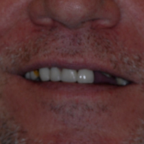 Before