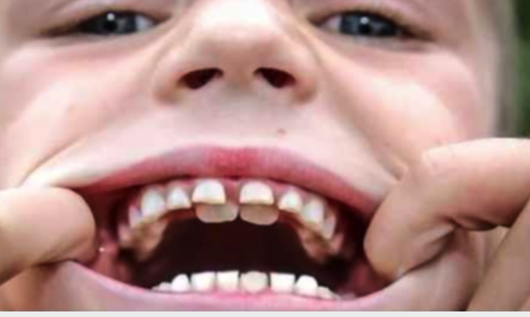 Roanoke-dentist-child