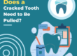 Does a Cracked Tooth Need to Be Pulled