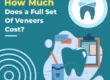 How Much Does a Full Set of Veneers Cost?