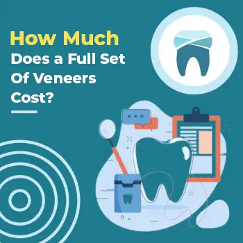 How Much Does a Full Set of Veneers Cost?